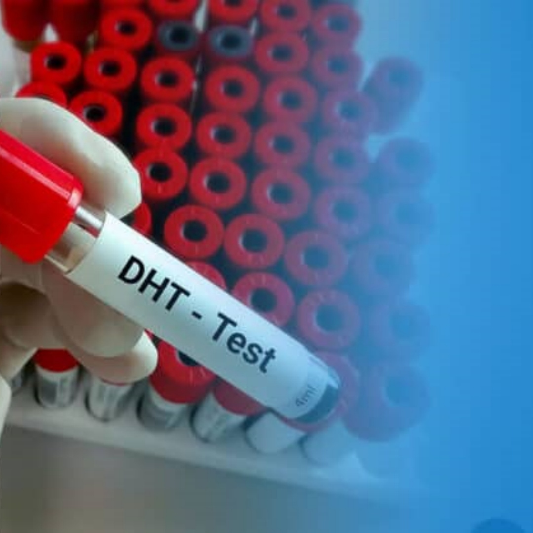 Stanolone (DHT) Dihydrotestosterone 50mg/ml Injection